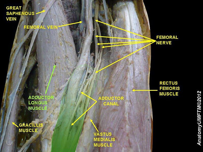 File:Slide3FFFFF.JPG