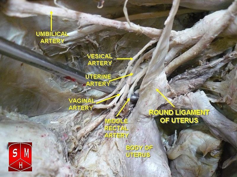 File:Hypogastric artery.jpg