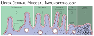 ”Coeliac Disease, Upper Jejunal Mucoasl Immunopathology”