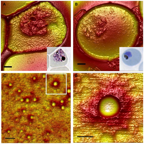 File:Erythrocyte knobs.png