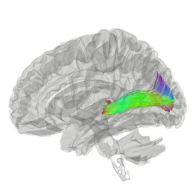 File:Optic Radiation.jpg