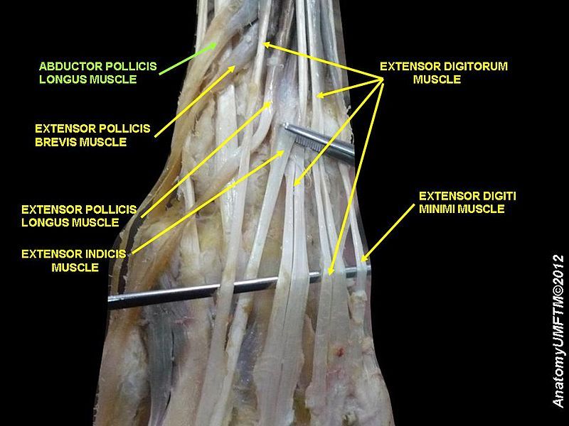 File:Slide1SSSS.JPG