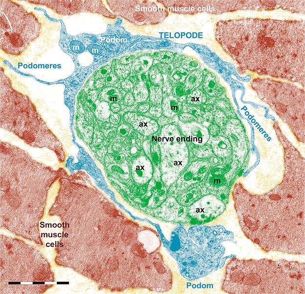 File:TC jejunum 2.jpg