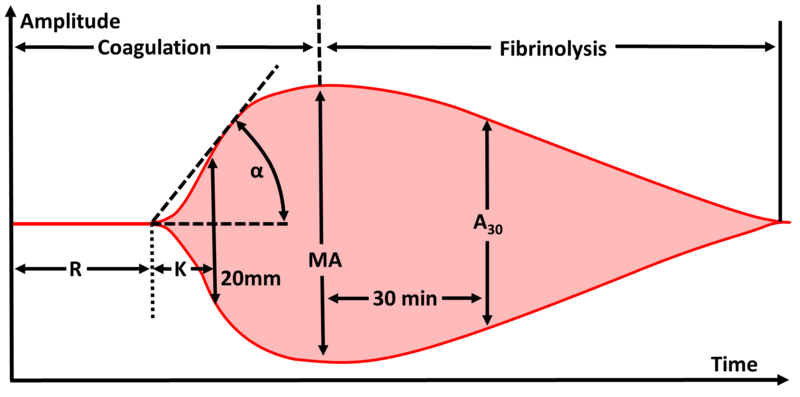 File:Thromboelastography parameters.png