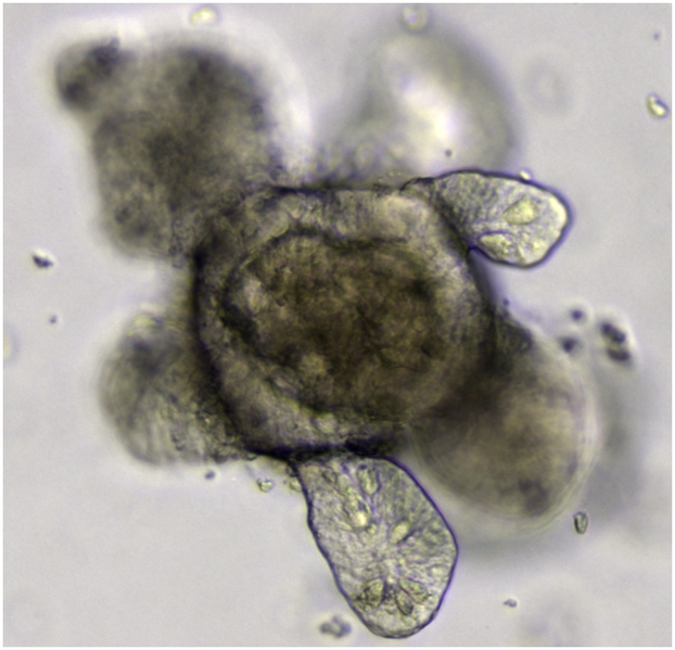 File:Intestinal organoid.PNG