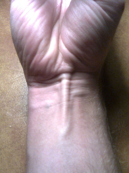 File:PL Tendon.png