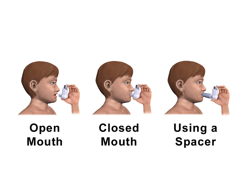 File:Metered-Dose Inhaler (Child).png