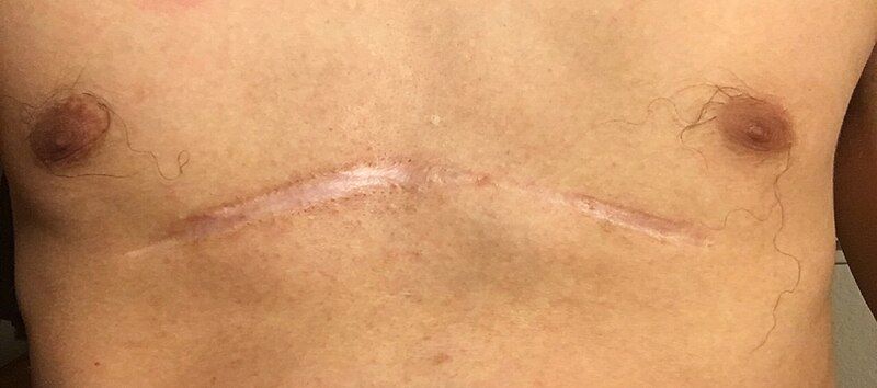 File:Ravitch Scar.jpg