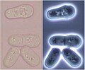 Division stages of Schizosaccharomyces in bright and dark field light microscopy