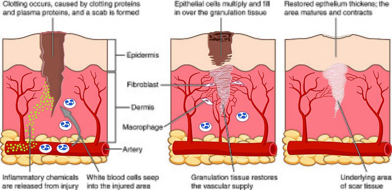 File:417 Tissue Repair.jpg