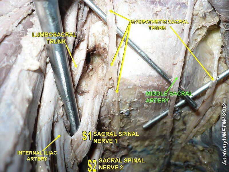 File:Slide12y.JPG