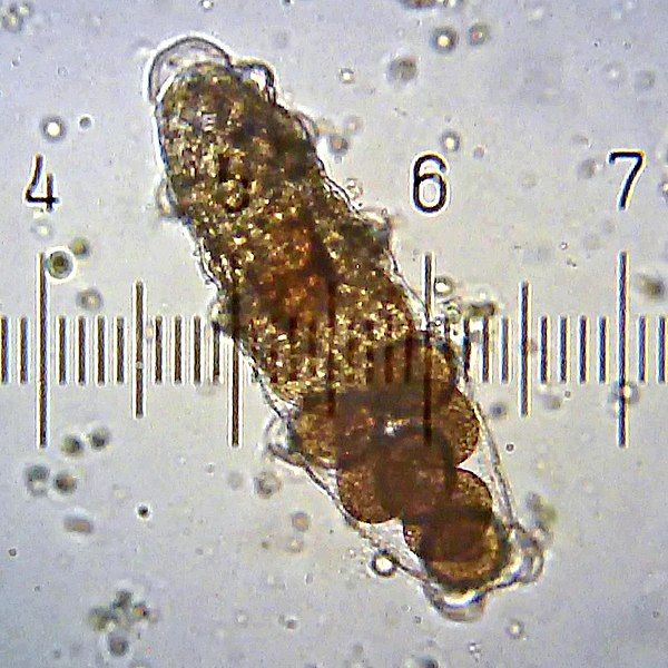 File:TardigradeEggsInShedCuticle.jpg