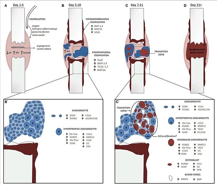 File:Endo Fracture.jpg