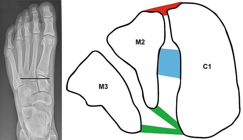 File:Lisfranc ligaments.jpg