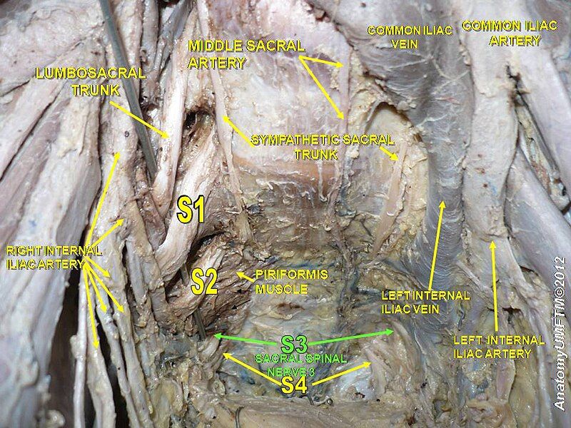 File:Slide20y.JPG