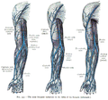 Three diagrams of the superficial veins of the arm, showing different arrangements of the median cubital vein, cephalic vein, and basilic vein.