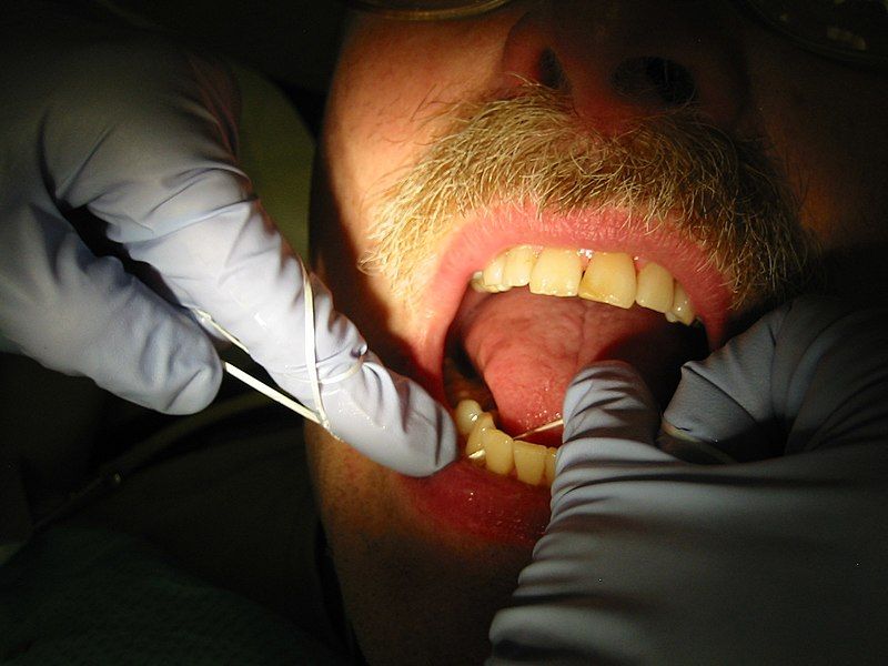 File:Dental flossing 9344.JPG