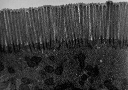 Transmission electron microscope (TEM) image of human jejunum