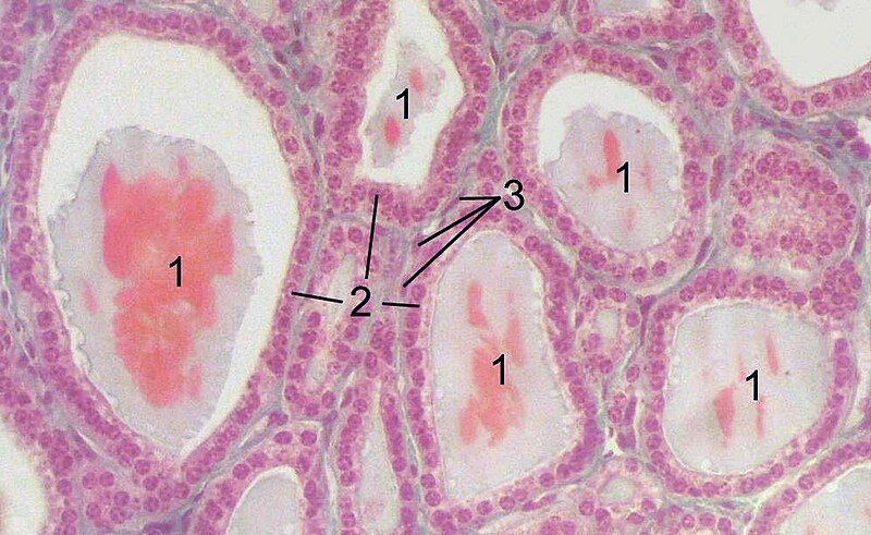 File:Thyroid-histology.jpg