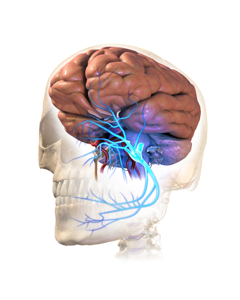 File:Trigeminal Neuralgia.png