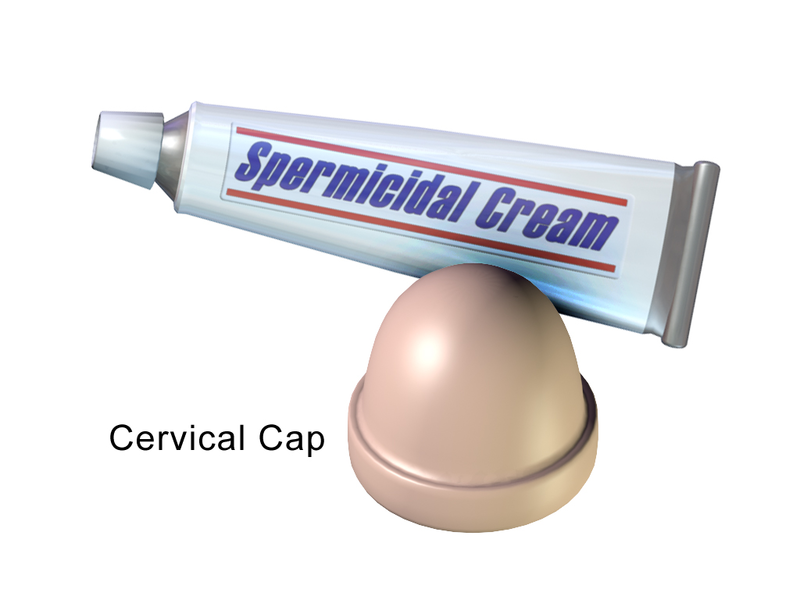 File:Cervical Cap.png