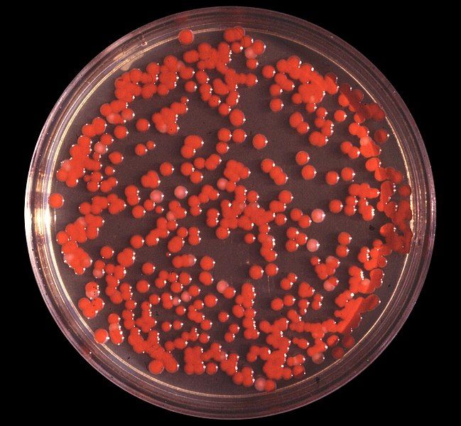 File:Serratia marcescens.jpg