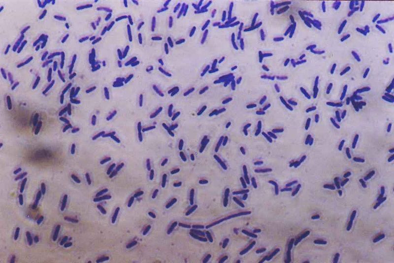 File:Bacteria photomicrograph.jpg