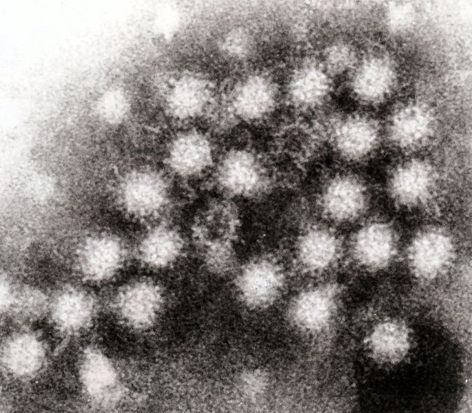 File:Norovirus 4.jpg