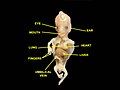 Human embryo, 38 mm, 8–9 weeks–anterior view, heart is visible.