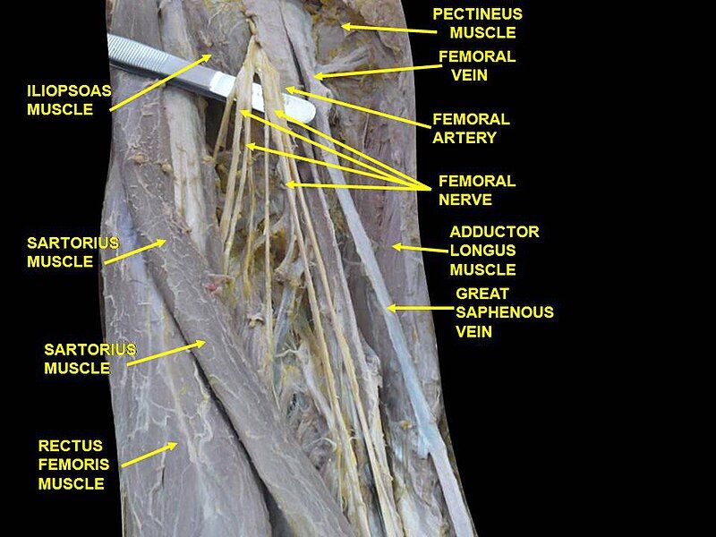 File:Slide2che.JPG