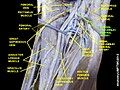 Lateral circumflex femoral artery