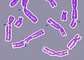 DNA damage resulting in multiple broken chromosomes