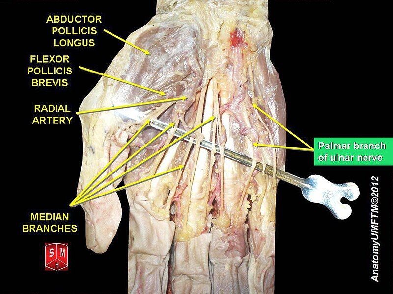 File:Slide1ll.JPG