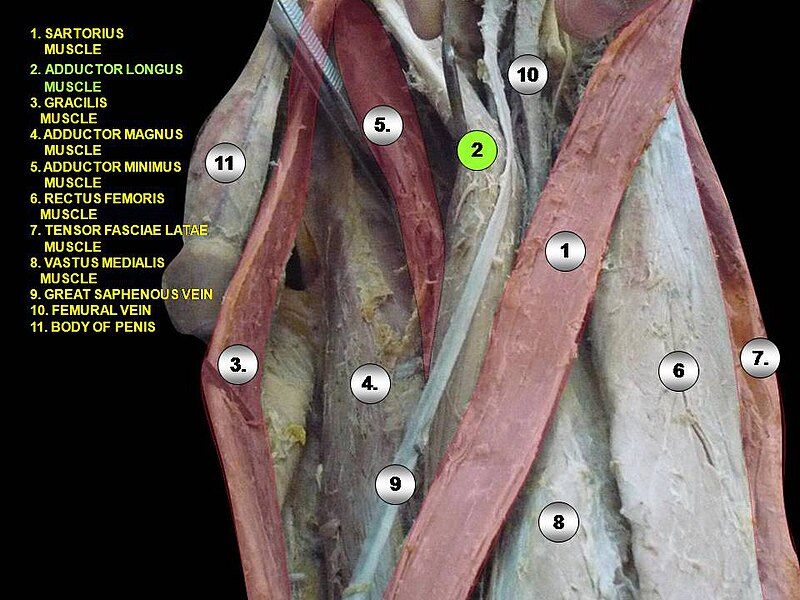 File:Slide2rrr.JPG