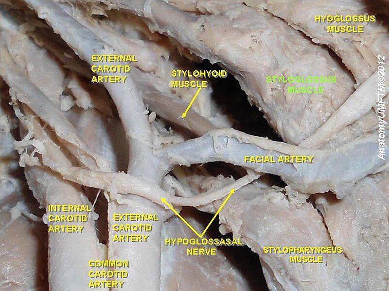 File:Slide8aaa.JPG