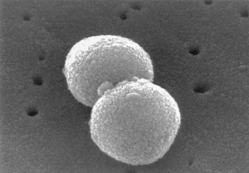 File:Streptococcus pneumoniae-263.jpg