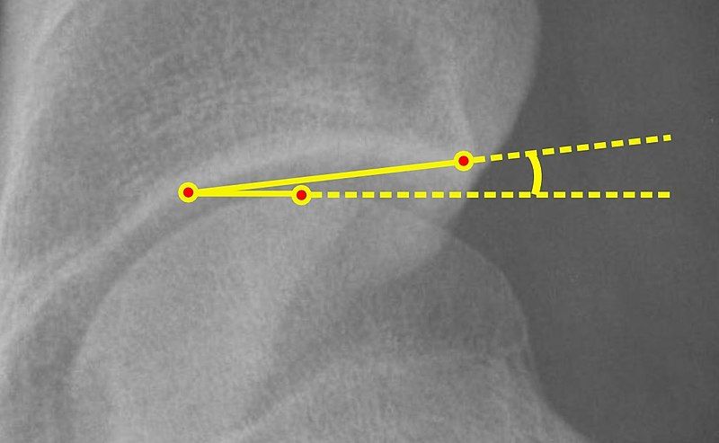 File:Caput-sourcil angle.jpg