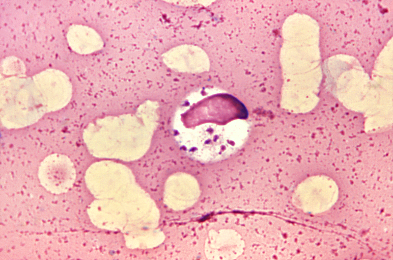 File:Leishmania donovani 01.png