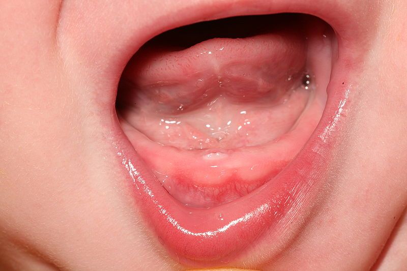 File:Teething 2.jpg