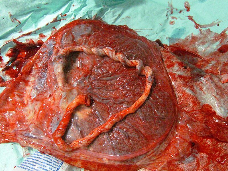 File:Human placenta 02.JPG