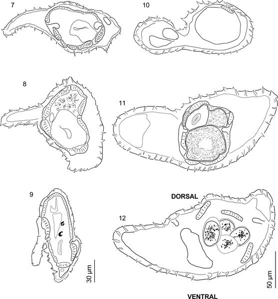 File:Parasite150083-fig2 Guerrerostrongylus marginalis.tif