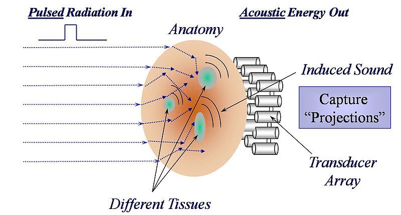 File:Thermoacoustic Imaging Approach.jpg