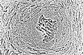 Light micrograph of undecalcified tissue displaying osteoblasts actively synthesizing rudimentary bone tissue (center).