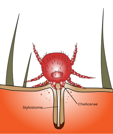 File:Chigger bite.svg