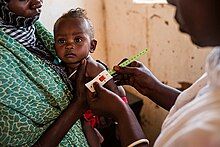 doctor measures the arm of a child being held by a family member