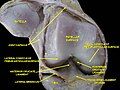 Knee joint. Deep dissection. Anterior view.