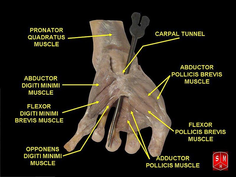 File:Hand dissection 9.jpg