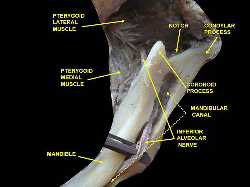 File:Slide6che.JPG