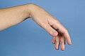 Wrist related tenodesis effect