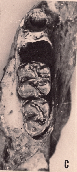 File:Megalomys audreyae molars.png